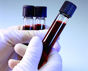 Blood samples